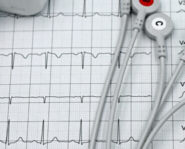 How to Apply for an EKG Tech Program and Secure Financial Aid