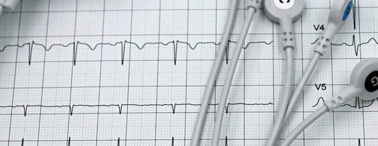 How to Apply for an EKG Tech Program and Secure Financial Aid