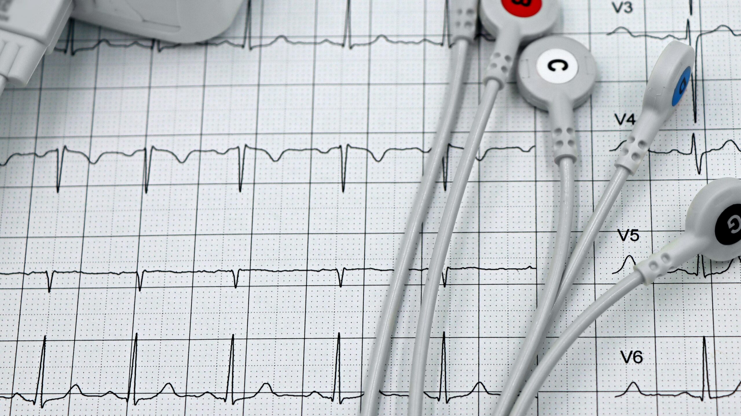 EKG tech program application and financial aid guide for prospective students