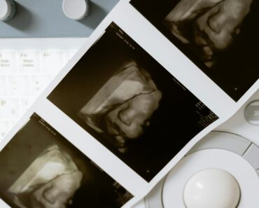 How Long Does It Take to Become an Ultrasound Tech? A Complete Timeline How Long Does It Take to Become an Ultrasound Tech? A Complete Timeline