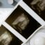 How Long Does It Take to Become an Ultrasound Tech? A Complete Timeline