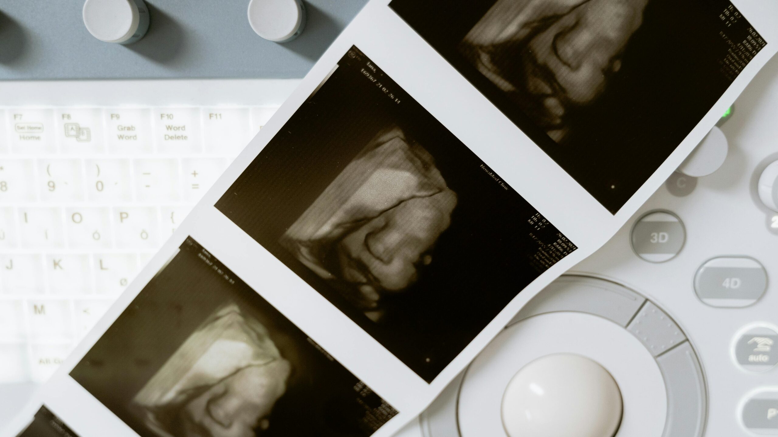 Timeline showing how long it takes to become an ultrasound tech from education to certification